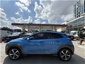 Hyundai KONA 1.6 CRDİ ELİTE SMART